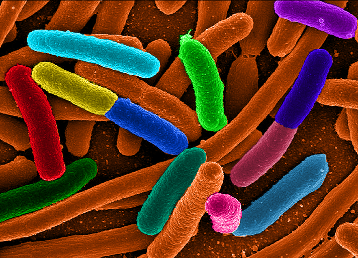 e_Coli