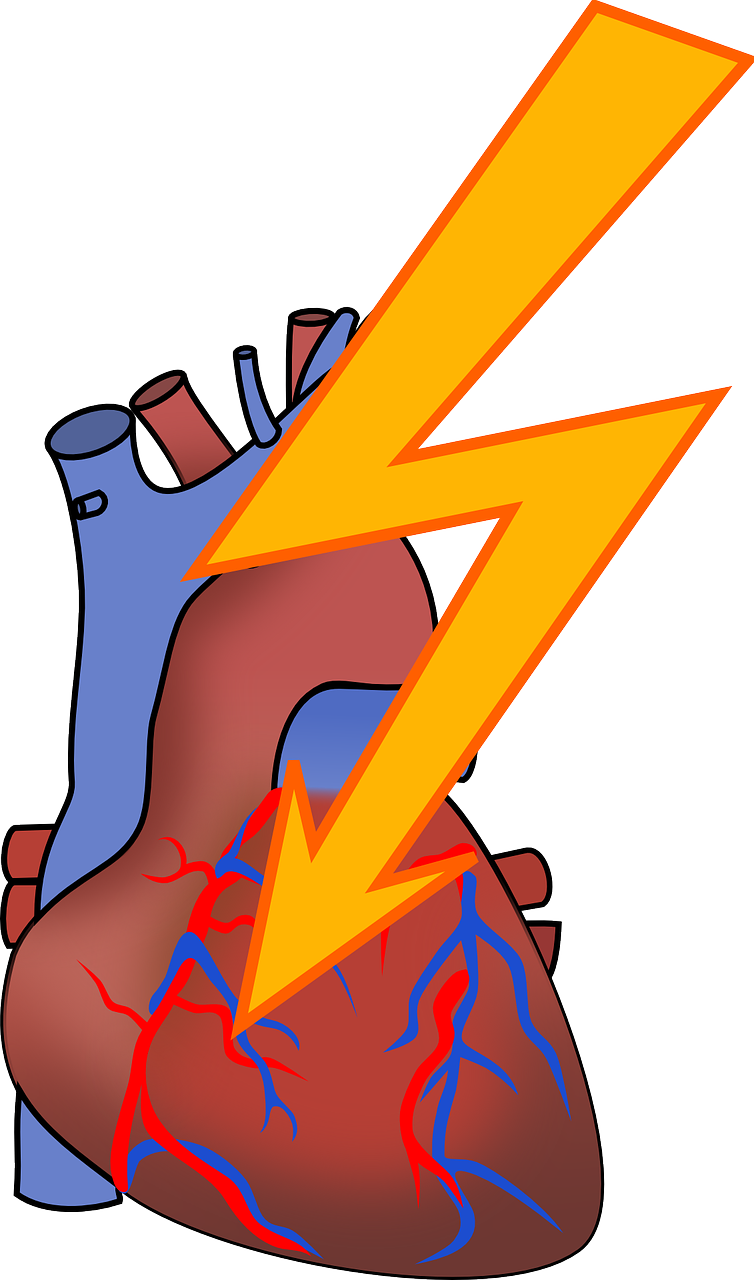 arrhythmia-156099_1280