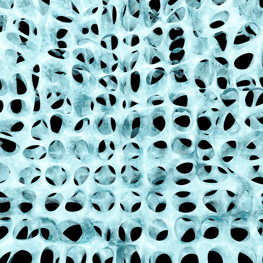 osteoporosis